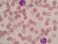 Pigment in neutrophils and myeloid cells 2