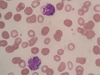 Pigment in neutrophils and myeloid cells 3