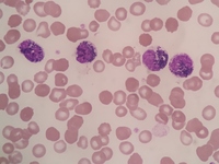 Pigment in neutrophils and myeloid cells 4