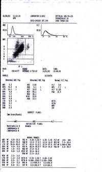 Megaloblastic Anemia Associated with Latent Ferrous Anemia