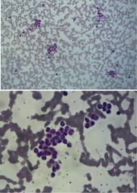 Peripheral Blood Smear - room temperature