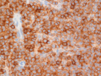 MCL-CD5