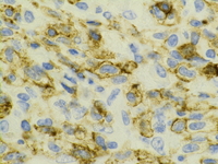 CD25 immunostain; 1000X oil objective.