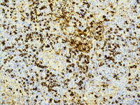 IgG immunostain; 200X objective.