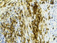 CD117 immunostain; 400X objective.