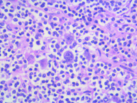 NLPHL HE  LP CELLS