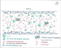 The pathogenesis of thrombosis in the MPNs. 1