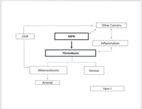 The pathogenesis of thrombosis in the MPNs. 2