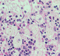 macrophage cell histology