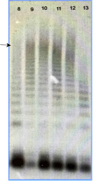 Gel electrophoresis- Von Willebrand Factor Multimer analysis