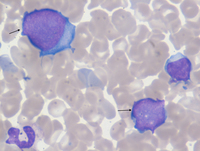 TAM smear - Fig 3