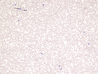 TAM smear (8 weeks) - Fig 6