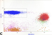 Lymphocytic variant of HES- Immunophenotype