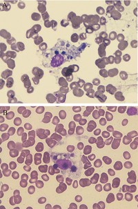 Macrophages (histiocytes)