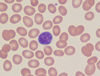 Mature lymphocyte