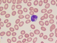 Cytotoxic lymphocyte