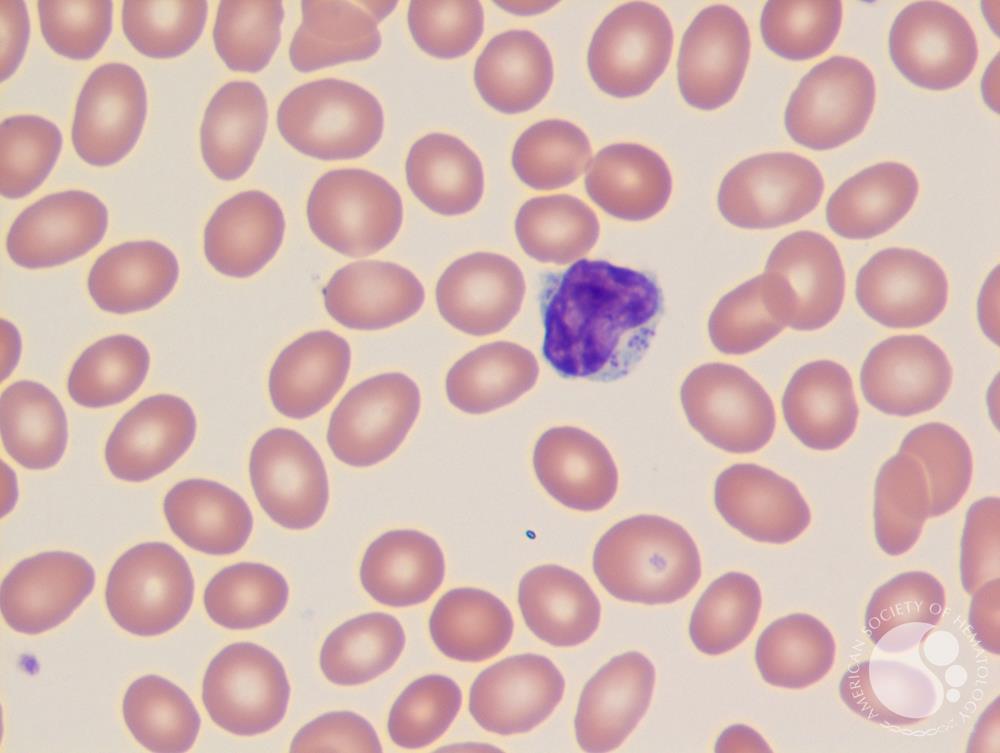 Cytotoxic lymphocyte