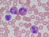 eosinophils vs neutrophils