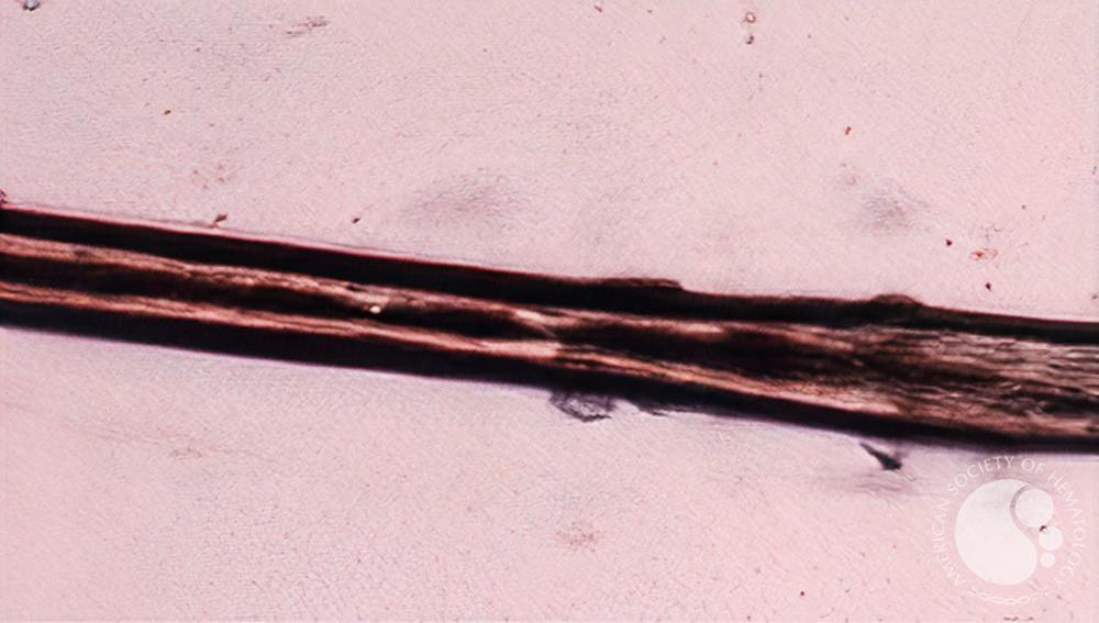 B. Light Microscopy of hair shaft showing evenly distributed melanin  granules of equal diameter.