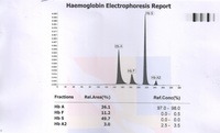 HEMOGLOBLIN ELECTROPHORESIS