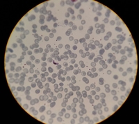 Macrogametocyte , Plasmodium falciparum