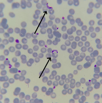 trypanosoma cruzi epimastigote