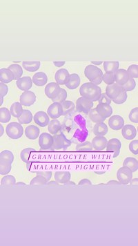 Granulocyte with malarial pigment