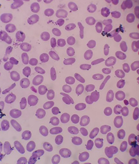 Elliptocytes in PBS 2