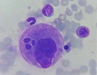 Megakaryocytic Emperipolesis 2