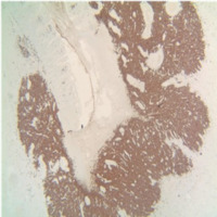 Figure 5. Ileum Biopsy Immunohistochemistry