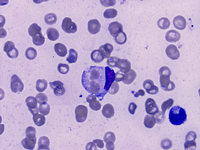 Panel A: erythrophagocytosis