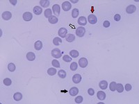 Panel B: intra-erythrocyte Babesia parasites