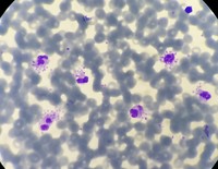 platelet satellitism