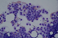 mast cells