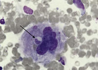 Emperipolesis in Megakaryocyte