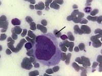 Promegakaryocyte