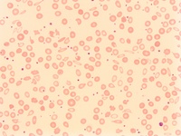 F) peripheral blood