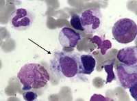 Bone Marrow Macrophage