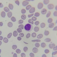 Lymphocyte