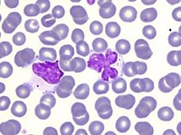 Large granular lymphocytes