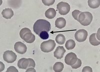 Erythroblastic Enucleation