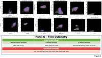 Mixed phenotype acute leukemia in thalassodrepanocytosis