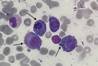 Mott Cells