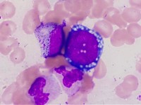 proerythroblast  showing prominent cytoplasmic vacuolation