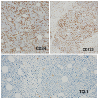 Marrow Biopsy Immunohistochemistry