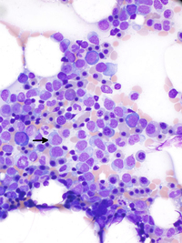 Marrow aspirate at low power