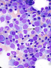 Marrow aspirate at High power