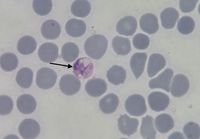 microgametocito de plasmodium vivax