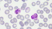 plasmodium vivax images