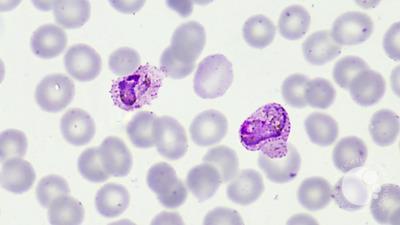 Plasmodium vivax ameboid trophozoites